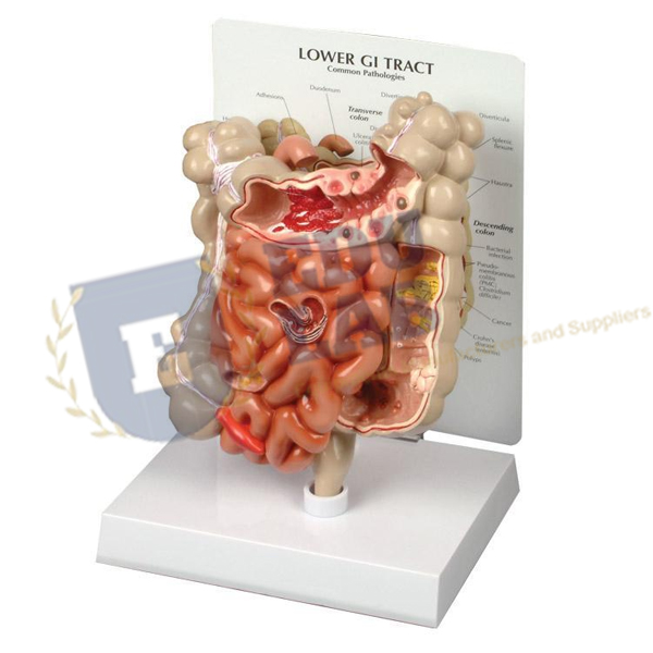 Lower GI Tract Model